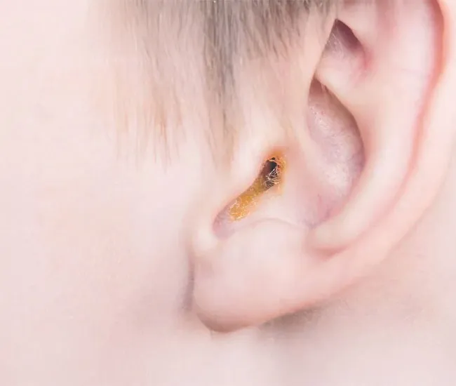 neuroaudiology